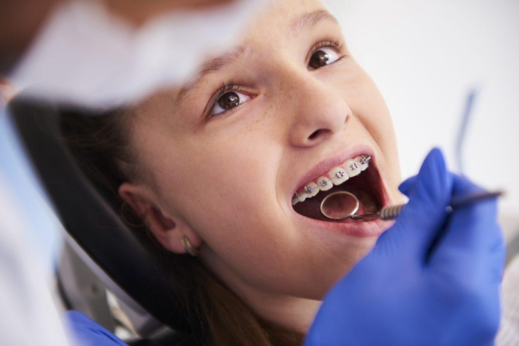 Antes de la ortodoncia - Alba Clinica Dental