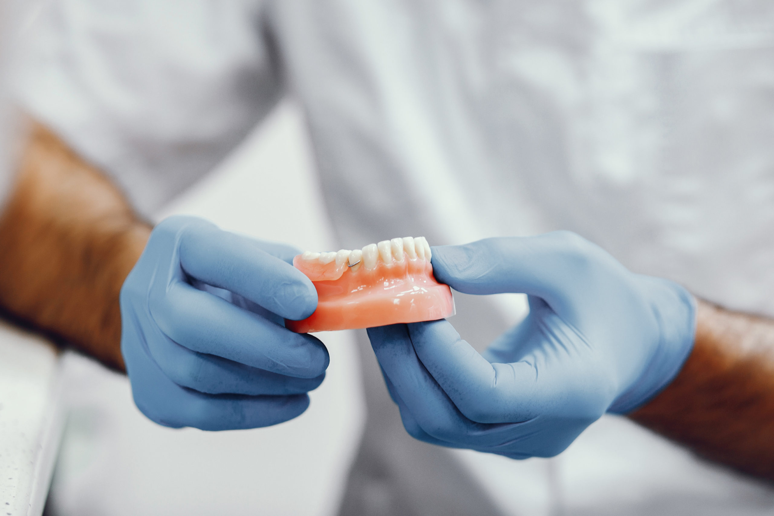 Implantes dentales vs. puentes dentales: ¿cuál es la mejor opción para ti?