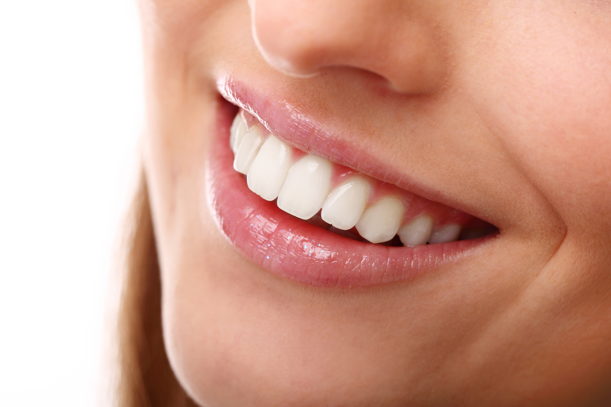 5 mitos sobre el blanqueamiento dental que debes conocer