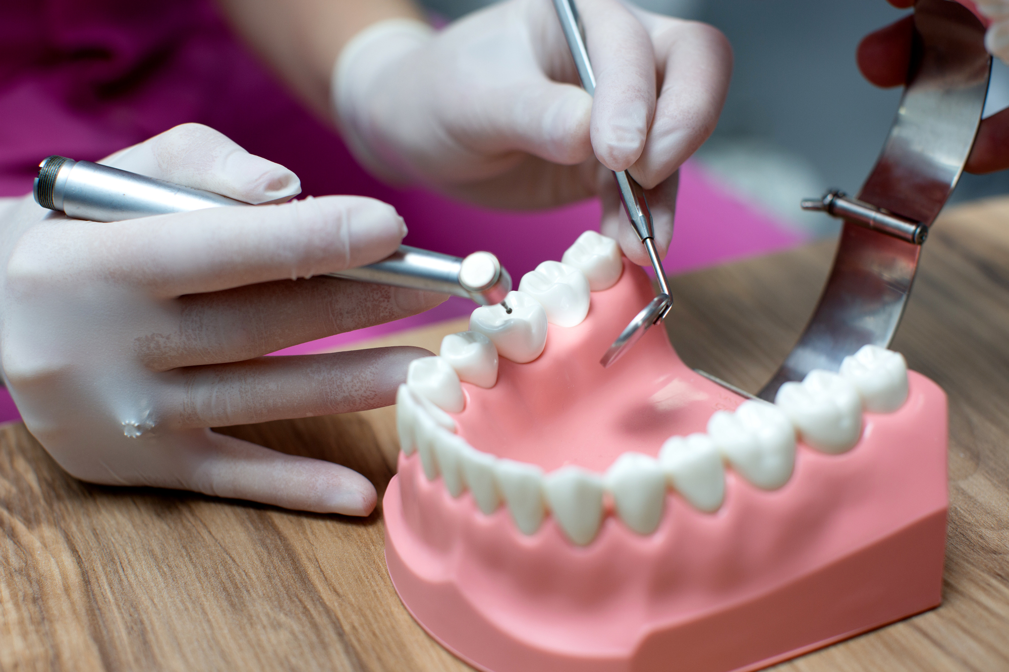 Tratamientos dentales que debes conocer