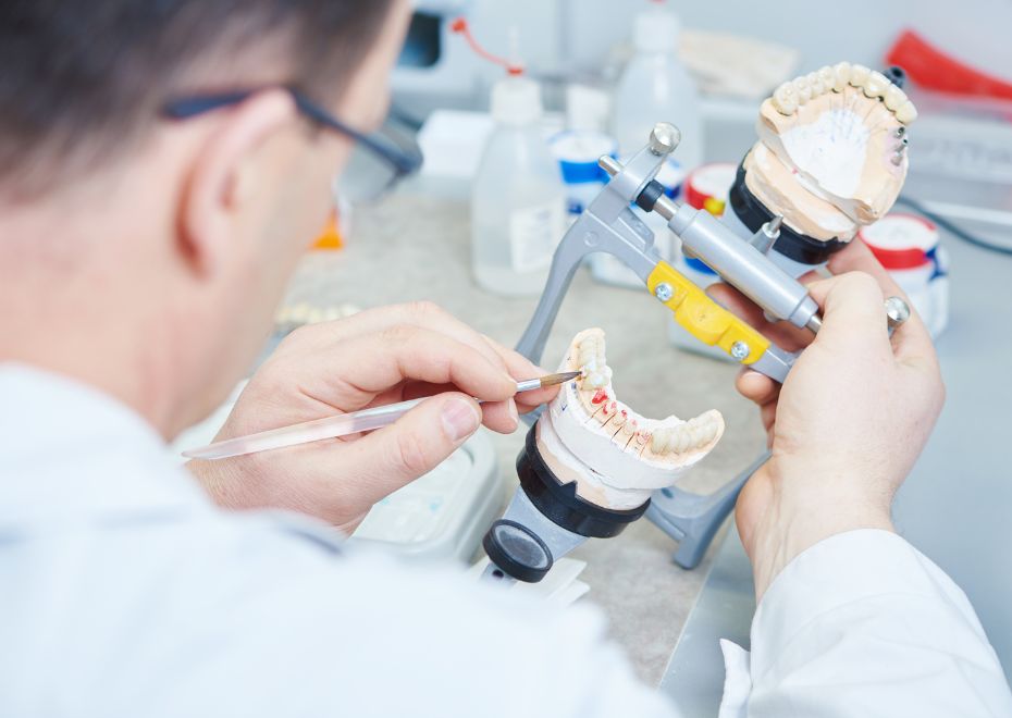 Todo lo que necesitas saber acerca de las amalgamas dentales