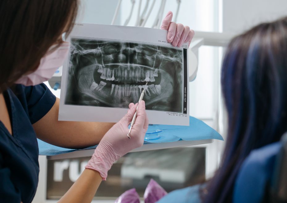 Qué hacer antes, durante y después del tratamiento de implantes dentales