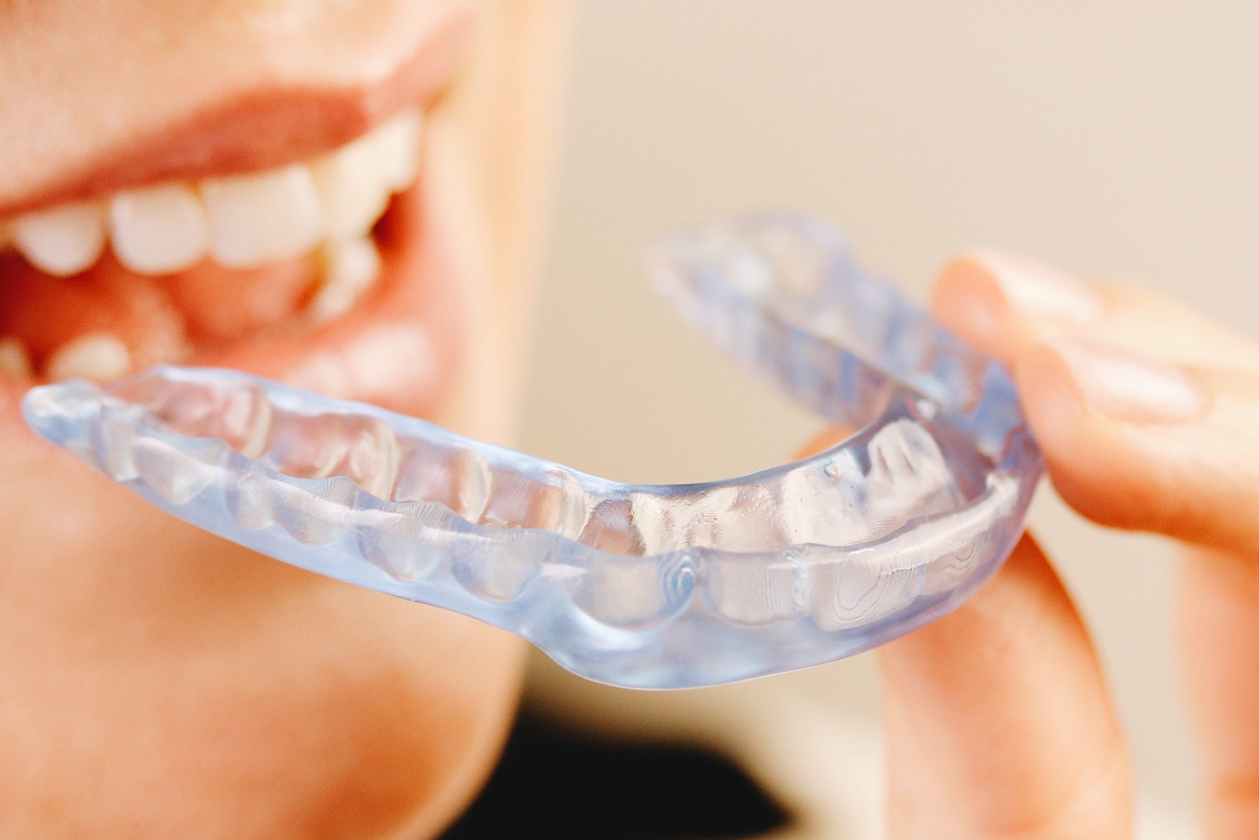 Por qué el bruxismo es un problema infradiagnosticado